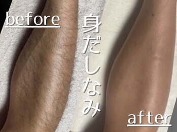 ラピスダズル(LAPIS DAZZLE)の写真/今から始めて夏までに完了！1回目から効果◎計画的にできて圧倒的コスパ&タイパ重視の男性専用脱毛サロン！