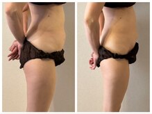 イデアール(Ideal)の雰囲気（ただ痩せるだけじゃ物足りない！辛いコリも改善5歳若見えボディ）