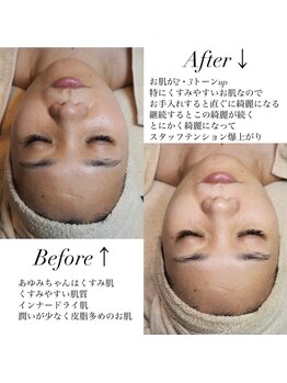 ウルケ(URUKE)の写真/透明感とハリツヤを引き出し、ノーファンデ毛穴レスを目指すエイジングケア★