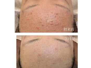 エステティックサロン シノヤ(Shinoya)