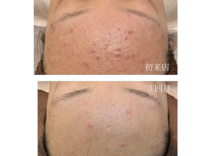 エステティックサロン シノヤ(Shinoya)の写真