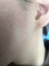 ジーワックス(G WAX)/毛穴ケアフェシャル