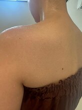 ココユール(cocoyull)/苦しくない！大量発汗