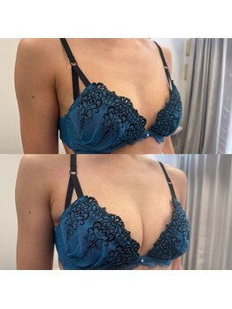 ジュエルリング(Jewel Ring)/バストアップ恵比寿・渋谷