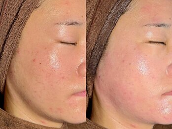 ルーナジェーナ(Luna llena)/