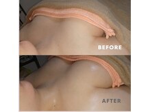 【進化形ストーン】バザルトで全身ボディメイク★バストアップも