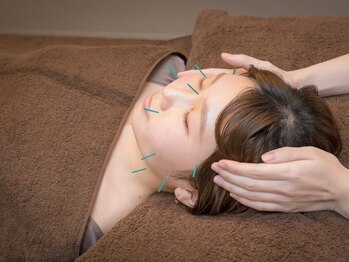 ビオラス(VIOLAS)の写真/《完全個室/マンツーマンで貴女だけの美容時間を…》美容鍼灸専門店♪専門機関推薦の超本格施術/肌質改善