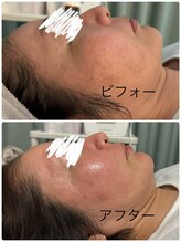 メディカルエステ ユウ(Yuu)/