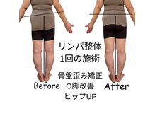 バランスサロン(BALANCE SALON)の雰囲気(整体のみ1回の施術で骨盤の歪み矯正と脚の矯正!)