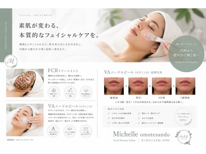 ミシェル(Michelle)の写真