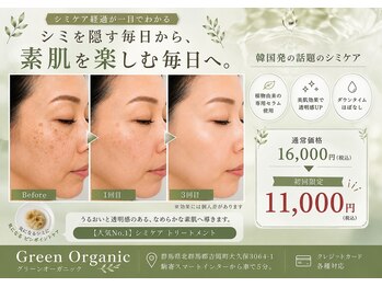 グリーンオーガニック(Green Organic)の写真/【群馬希少★レーザーなしのシミケア】ピンポイント照射で徹底改善！痛みを抑えてピンッと弾む透明肌へ