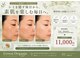 グリーンオーガニック(Green Organic)の写真/【群馬希少★レーザーなしのシミケア】ピンポイント照射で徹底改善！痛みを抑えてピンッと弾む透明肌へ