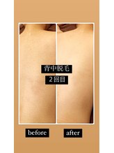 ツリービューティー(Tree Beauty)/before after