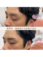 ダイヤモンド ビューティーラウンジ(DBL)/メンズも眉で変わる！！