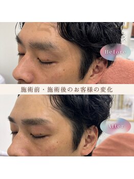 ダイヤモンド ビューティーラウンジ(DBL)/メンズも眉で変わる！！