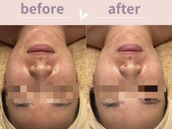 アール(R)/気になるお肌のお悩みに！