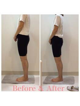 スタイルラボ高松/産後骨盤矯正の効果♪