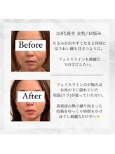 メディカルエステ 東銀座店/30代後半 女性