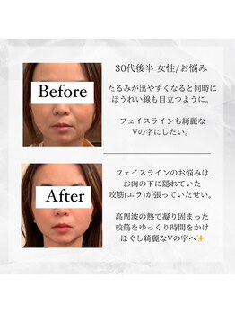 メディカルエステ 東銀座店/30代後半 女性