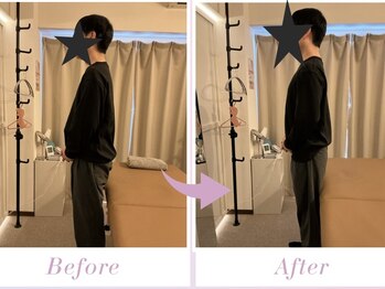 サクラ(SAKURA)の写真/【五反田駅徒歩3分】21時まで受付だから仕事終わりにも通える◎慢性的な首・肩こりの原因を徹底分析。