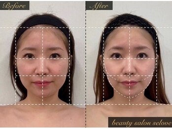 「小顔に本気。」都度払い小顔専門店beauty salon seloveの写真/別府NEW OPEN★初回￥7800で圧倒的小顔!最新衝撃波で筋膜&靭帯から強力引き締め♪コースなし完全都度払い！