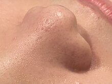 メガミノチカラ/【セルフ】フェイシャルマシン