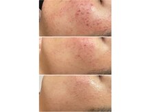ソワイユ 東銀座店(Soyeux)の雰囲気（本気の肌質改善↑肌の自活力を高めます♪）