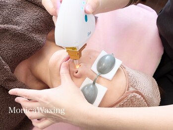 モニカワクシング(MonicaWaxing)の写真/【光顔脱毛/フェイスワックス】気なる産毛を無くしてワントーン明るいお肌のお顔に◎