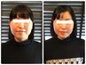 《当日限定★お試し！当店人気No.1☆》即実感！小顔美矯正単品→¥5,280