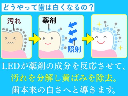 ホワイトニングショップ くずは店の写真
