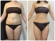 ウェリナ 一宮院/.【ダイエットbefore→after】