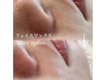 リベルキョウト 京都駅前店(Liber Kyoto)/フェイスワックス脱毛