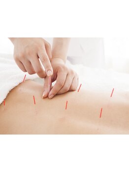 鍼灸施術を受けたい