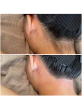 ザ ビードットデザイン(The b. design)/ビフォーアフター