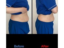 鍼灸接骨慈康院/ダイエットプログラム！