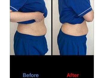 鍼灸接骨慈康院/ダイエットプログラム！