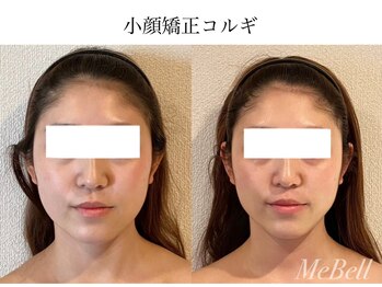 ミベル(MeBell)/小顔コルギ