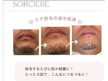 ソルシエール(Sorciere)の雰囲気（痛みの少ない最新の光脱毛で、清潔感UP◇）