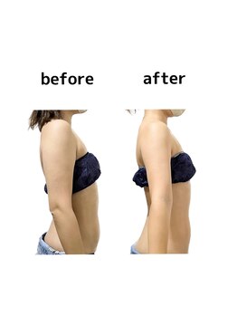 ステラ(stella)/身体の厚みをなくす