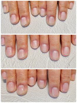 アトリエ グリッター(atelier glitter)/ネイルケアのお客様