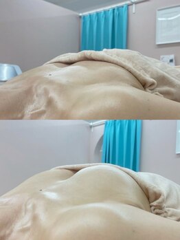 美人バスト 横浜店/バストアップ/育乳(10回施術)