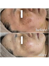 セリー(Celie)/お客様症例