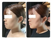 ディアビム(DiAViM)の雰囲気（1~2週間かけ脂肪を燃焼するレモンボトル正規取扱店★小顔＆美肌）