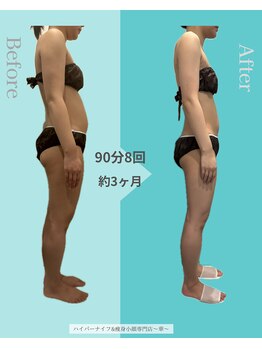 華(hana)/ブライダル痩身