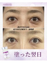 ルルアス(LuLu AS)/塗って飲めるレチノール