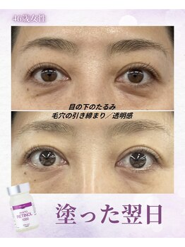 ルルアス(LuLu AS)/塗って飲めるレチノール