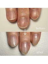 ジル(JiLL)/【自爪育成】