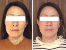 美容整体ウェリナ 名駅院/小顔矯正/骨盤矯正/痩身整体