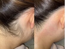 シンボディメイク 恵比寿(SiN BODY MAKE)/うなじワックス※光脱毛に変更可