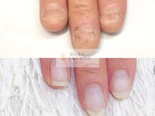 グラシナ なんば店/深爪/噛み/むしり癖/長さ出し